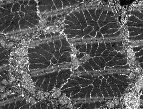 Image de microscopie électronique