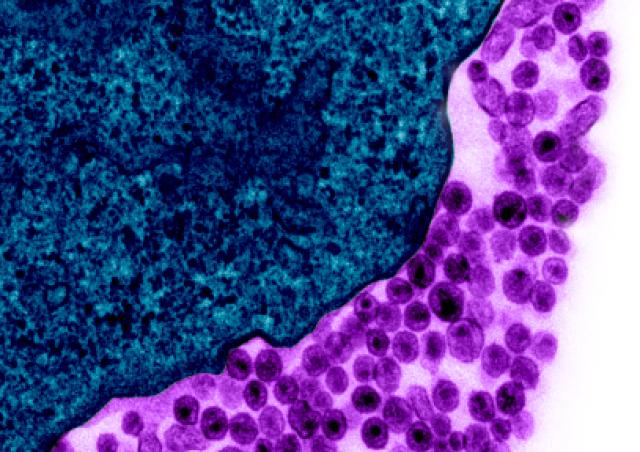 Le virus VIH-1 du SIDA (violet) à la surface d&#039;une cellule infectée (bleu)