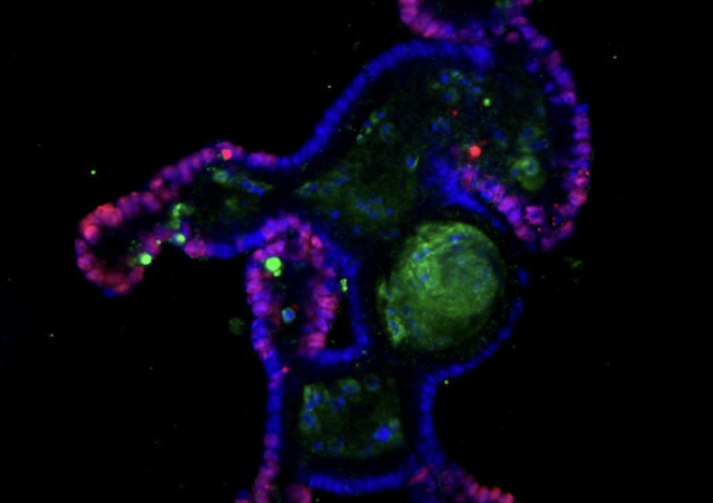 photo microscopie à fluorescence projet Axine 1 et tumorigenèse intestinale