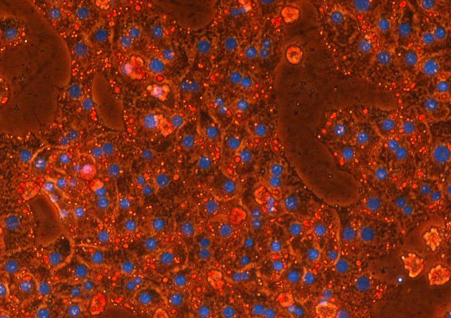 image microscopie projet Métabolisme lipidique, mitochondrie et maladies métaboliques équipe Bouillaud