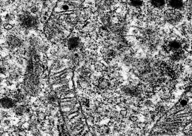 Mitochondries vues en microscopie électronique