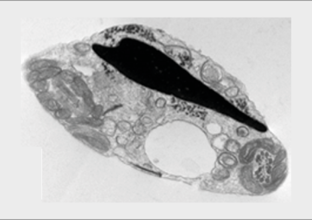 spermatozoïde Dot1l-KO montrant une rétention cytoplasmique
