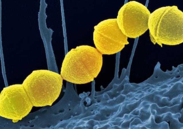 Streptocoques groupe A